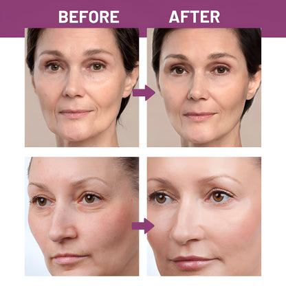 Renox Calcium Volume Multi Balm